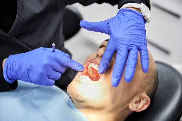 Best Emergency Root Canal Treatment in Somerville, MA